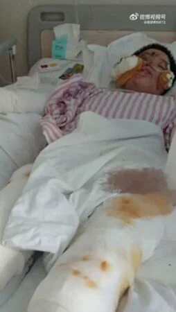 追求女神被拒“怒泼硫酸、刀毁容” 中国男子被执行死刑