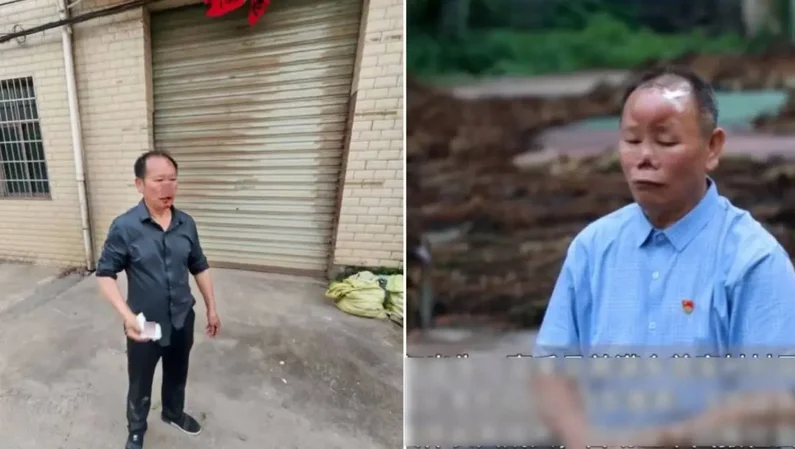 鼻子被暴徒咬吞下肚!中国男子缝115针 “舍鼻救人”感动全网