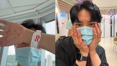 法国登山惊爆被昆虫叮咬 陈浚霆全身红疹停工留院