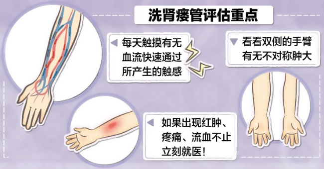 deep-vein-thrombosis (2).jpg